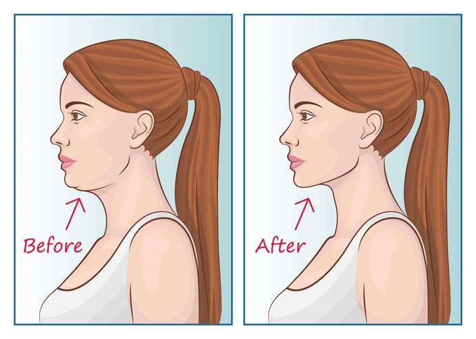 Is mewing bad for health?
