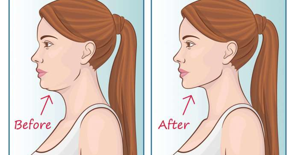 Is Mewing Bad Is Mewing Bad