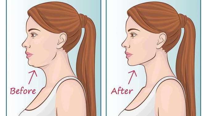 Is mewing bad for health?