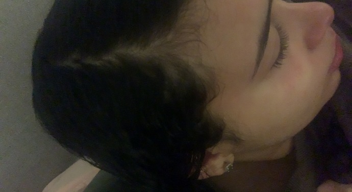 Do you guys see any balding? Does it look like I’m balding?