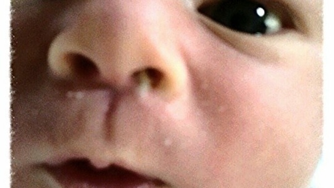 Do you tell people when their breath stinks, or when they have a rogue booger?