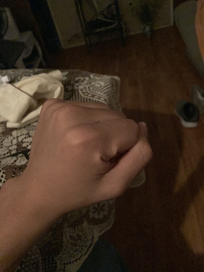 I need a quick opinion?