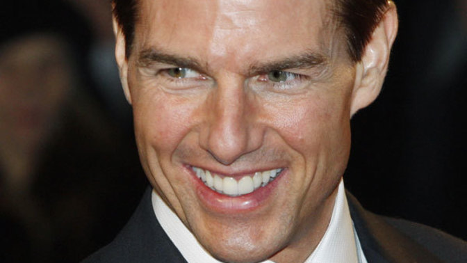 Girls, Are Veins on forehead attractive on men?