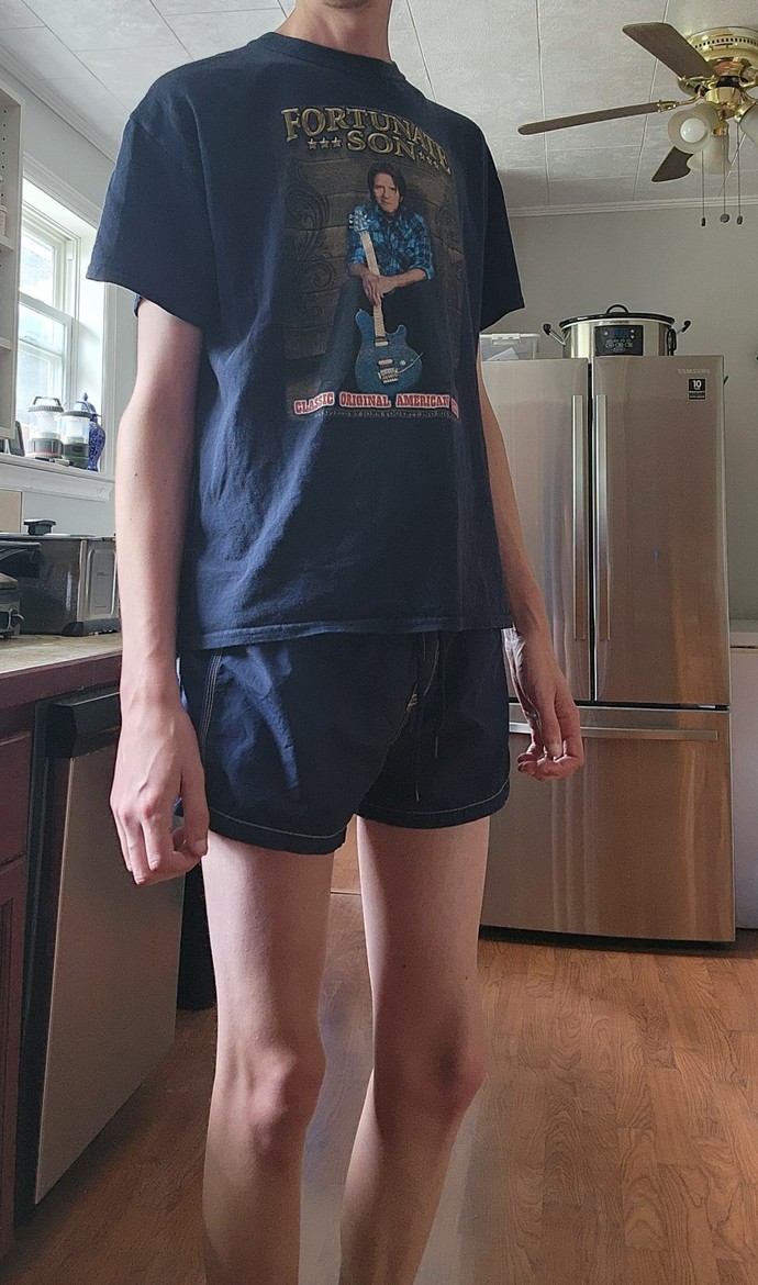 Girls, would you say something to me if u saw me wearing these shorts?