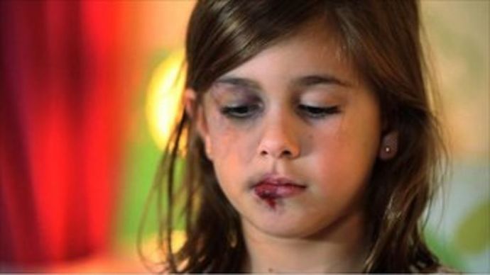 What if anything should society do about parents that abuse and sometimes severely injure or kill their children?