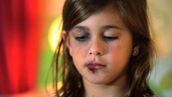 What if anything should society do about parents that abuse and sometimes severely injure or kill their children?
