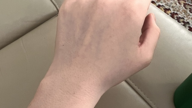 What is my SKIN UNDERTONE…so confused?