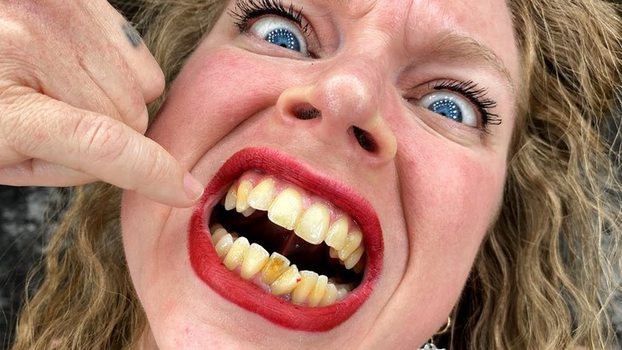 Would you rather date a girl with ugly teeth or a girl with a really fat booty?