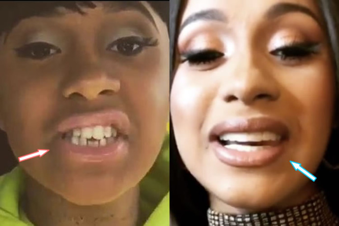 Were Cardi B‘s teeth really thst bad?