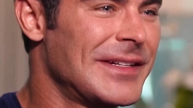 Thought’s On Zac Efron’s New Look? Think He Had Plastic Surgery?