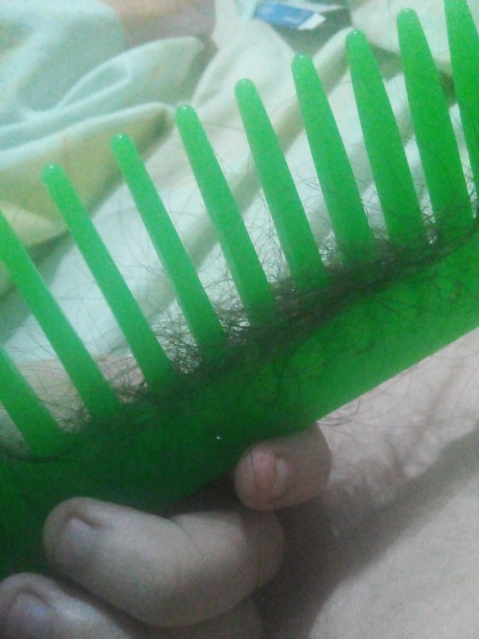 Is it normal for me to lose this amount of hair or should I go to the dermatologist?