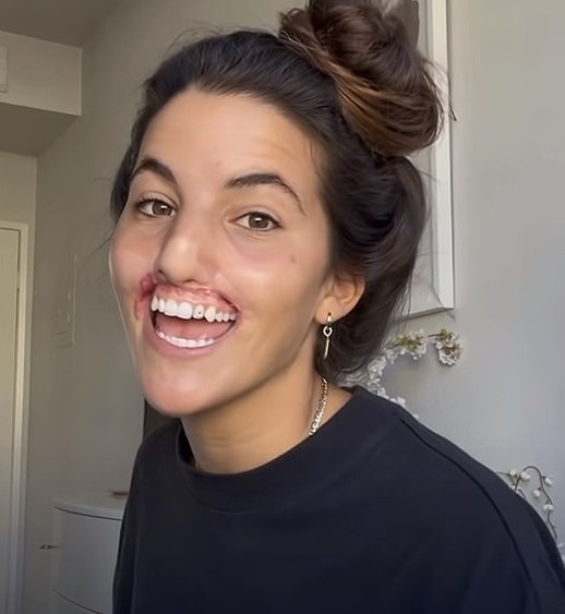 What's an important facial feature on a woman that she needs to be attractive?