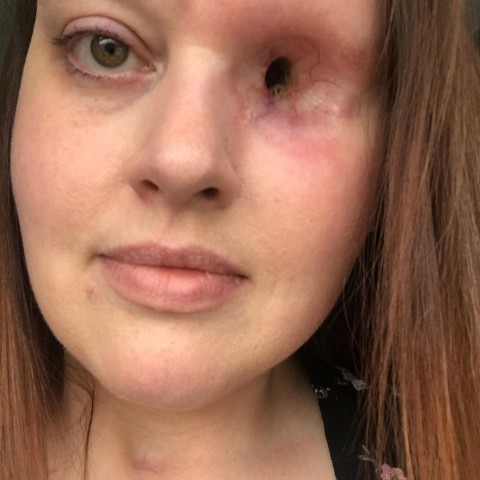 What's an important facial feature on a woman that she needs to be attractive?