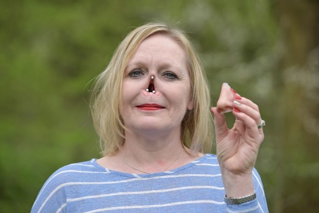 What's an important facial feature on a woman that she needs to be attractive?