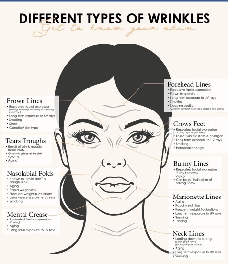 Is there a wrinkle cream out there that actually helps to lessen them?