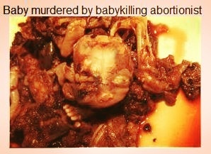 Share your thoughts: Is Abortion Murder?