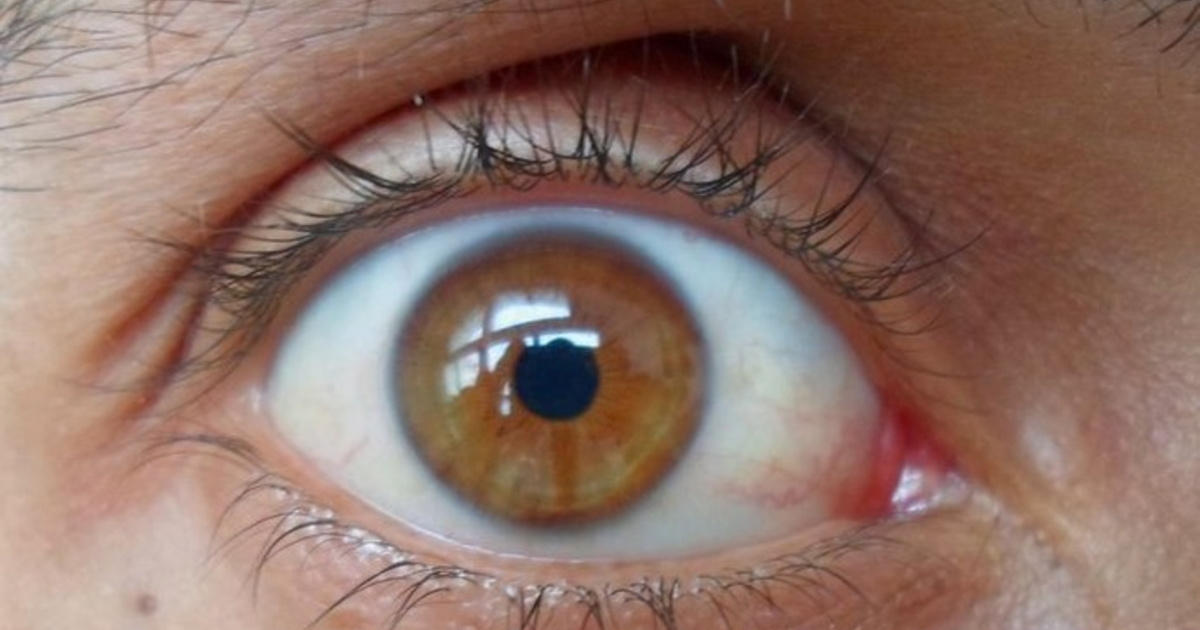 What is the most attractive brown eye shade? GirlsAskGuys