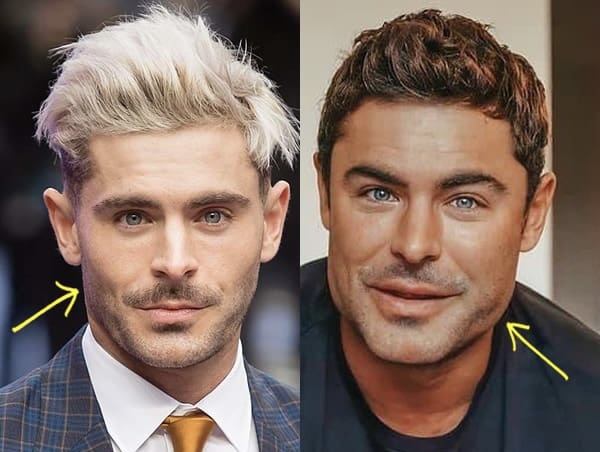 What tf happened to Zac Efron’s face?