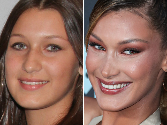 Why do most celebrities lie about their plastic surgery procedures?