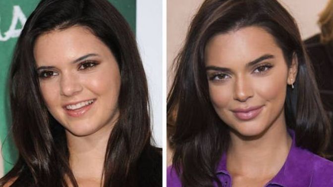Why do most celebrities lie about their plastic surgery procedures?