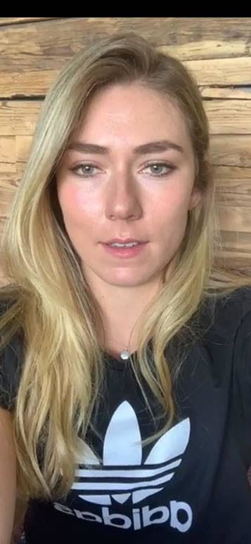 Do you find people with thin lips better looking or people with big lips better looking?