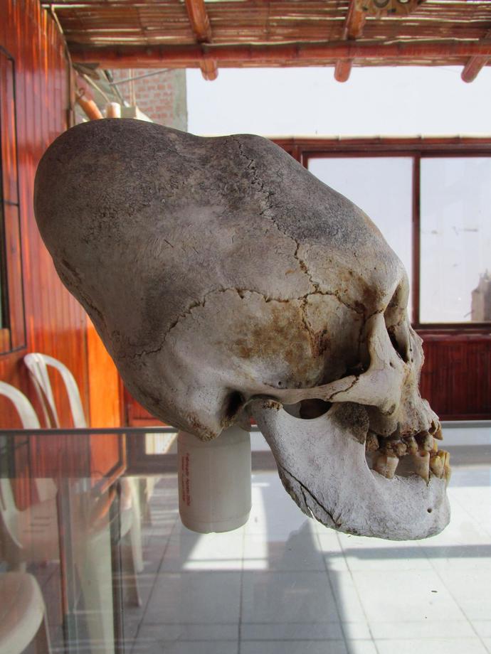 Do you think aliens exist?