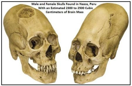 Do you think aliens exist?