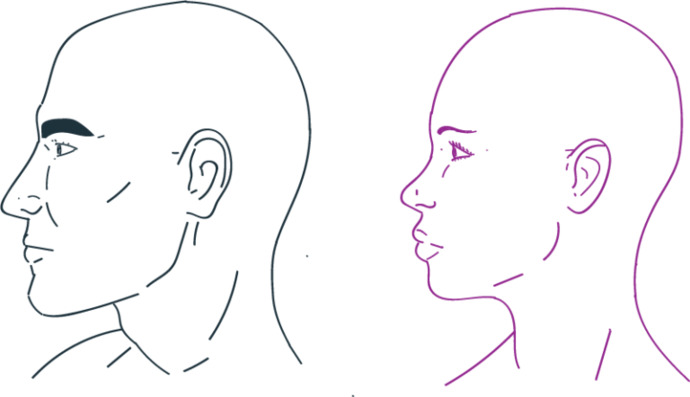 Guys who are taller than your moms, is her head larger than yours? Is her forehead more sloping, and is yours more vertical? Or both? Or none of them?