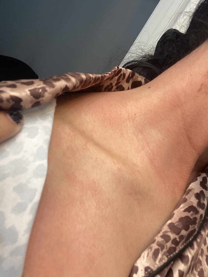 HELP why did my face and neck and whole body turn red and itchy?