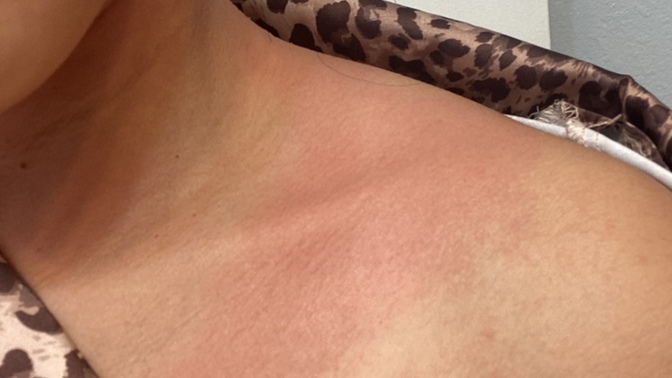 HELP why did my face and neck and whole body turn red and itchy?
