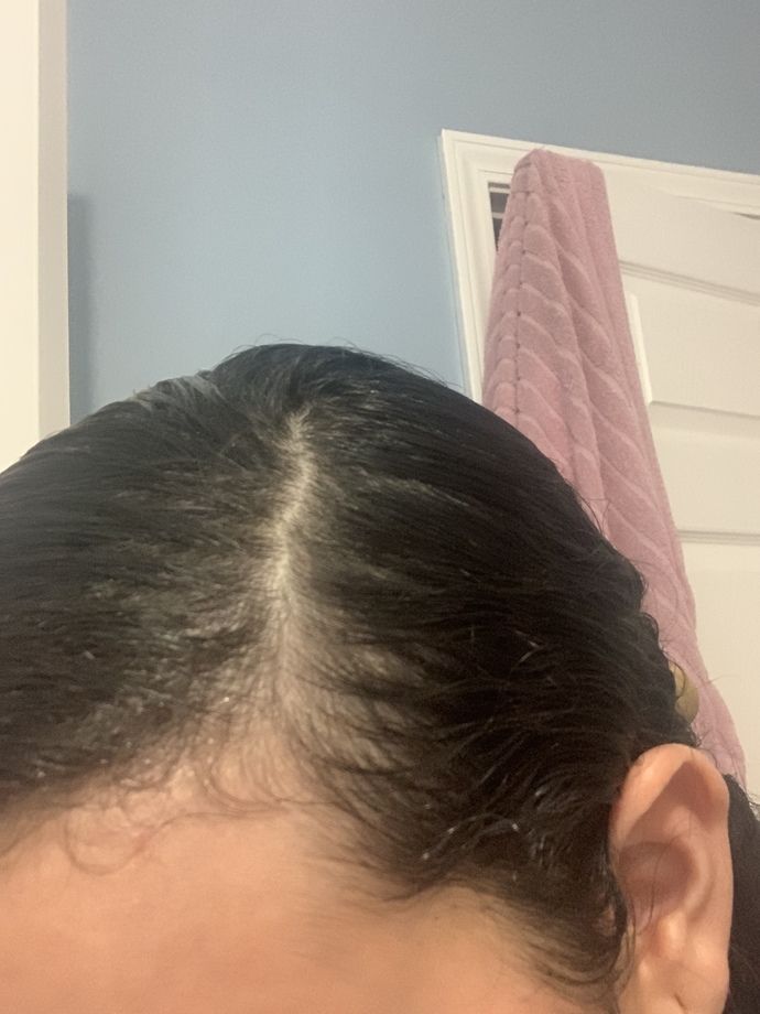 Is this hair loss?