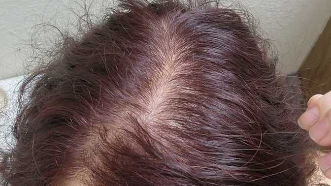 Would guys date balding women?