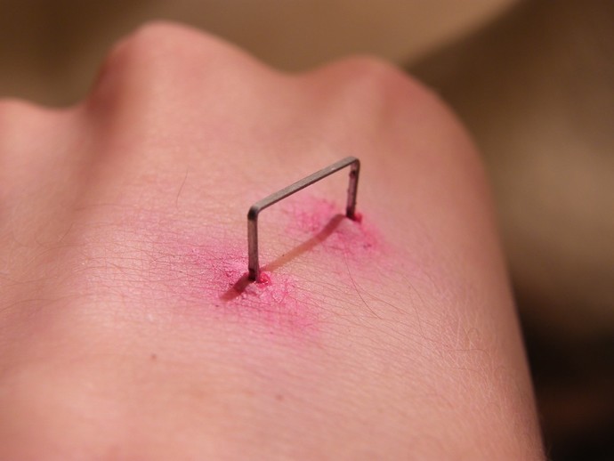 Yes, this is meant to be a fun Q (& is a fake injury)