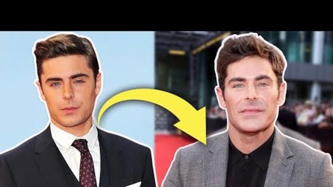 Do you think Zac Efron Had Plastic Surgery?