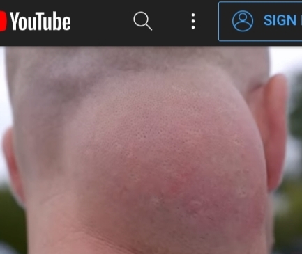 This guys problem what should have he done?