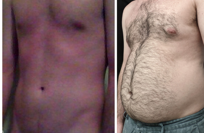 Girls, do I look better skinny or dad bod?