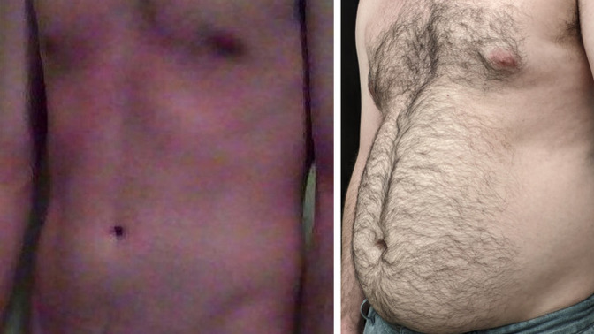 Girls, do I look better skinny or dad bod?