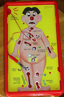 Have you had surgery?
