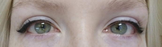 I couldnt take a better picture. :|