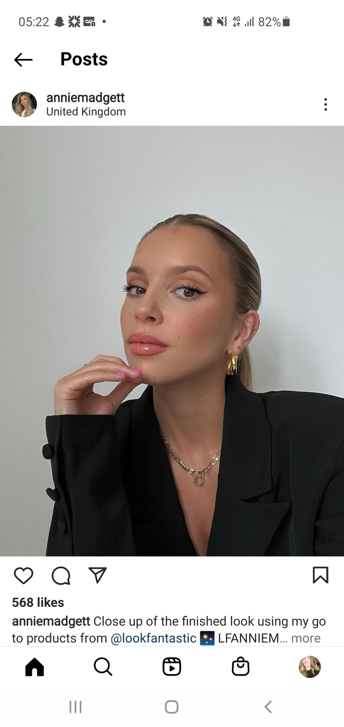 Why is there so many girls getting fillers and botox in their 20s?