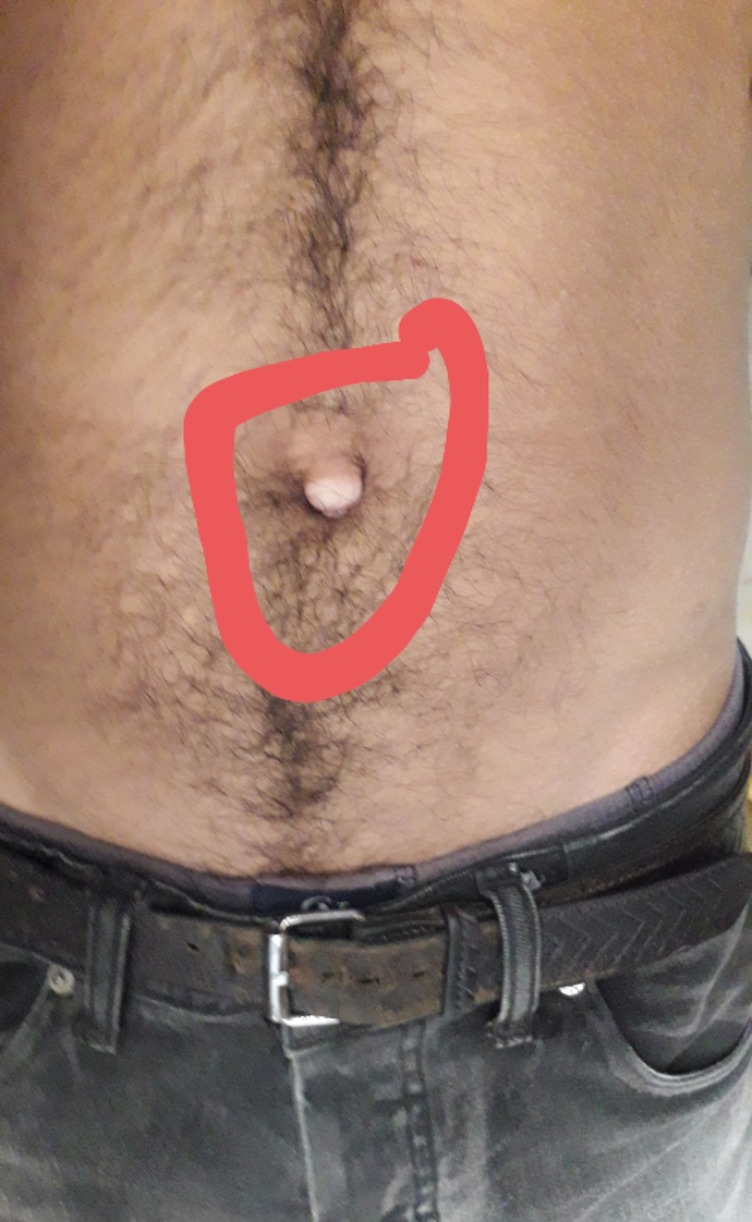 Should I fix this with surgery?
