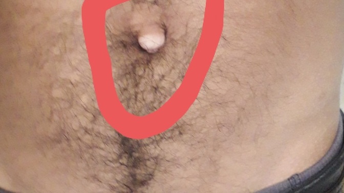 Should I fix this with surgery?
