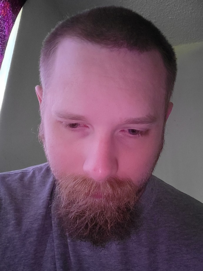 Does it look like my hairline is receding?