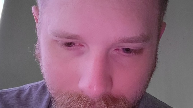 Does it look like my hairline is receding?