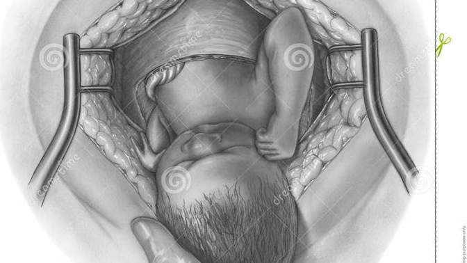 C section or natural birth, which is more horrifying?