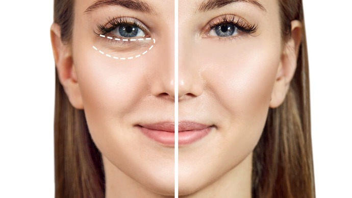 Do you find eyebags unattractive/attractive? At what age do people generally get it?
