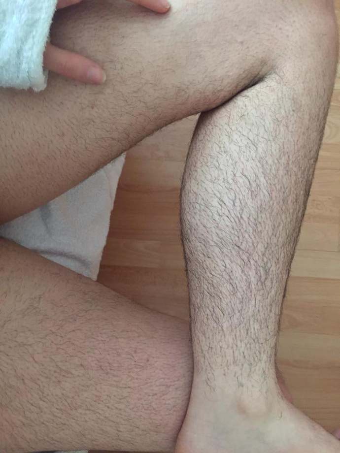Are these average and common normal amount of leg hair for a woman?