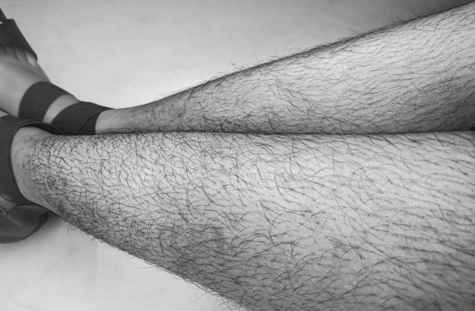 Are these average and common normal amount of leg hair for a woman?