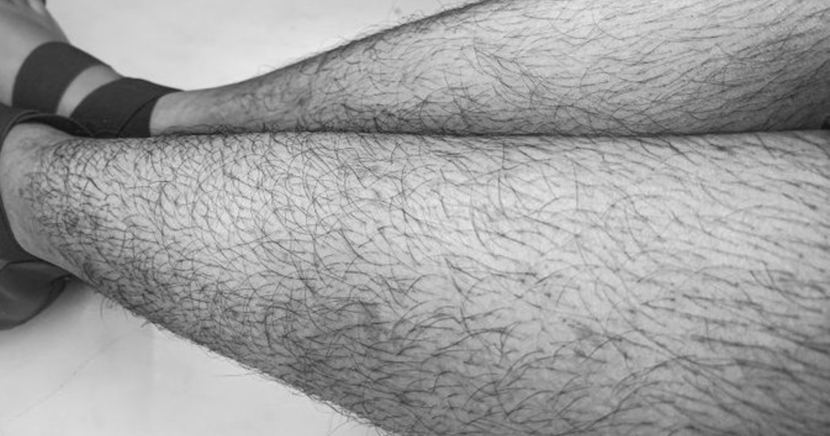 Are these average and common normal amount of leg hair for a woman? GirlsAskGuys
