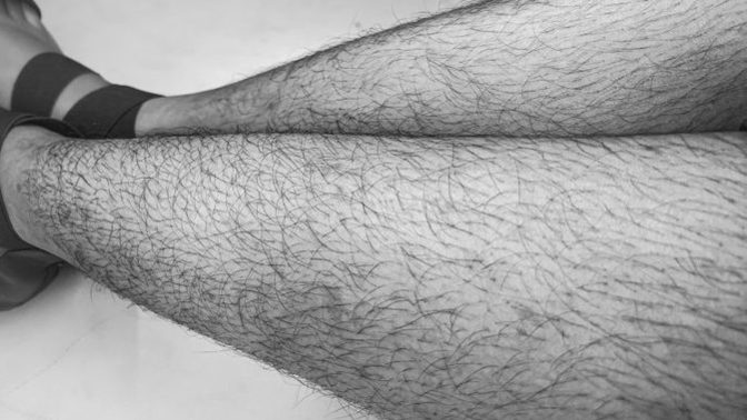 Are these average and common normal amount of leg hair for a woman?